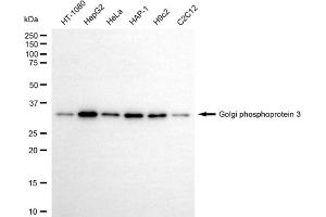 anti-Golgi phosphoprotein 3 (Coat-Protein) (GOLPH3) antibody