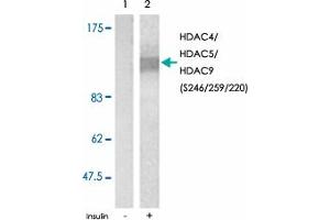 Western blot analysis of extracts from NIH/3T3 cell using HDAC4/HDAC5/HDAC9 (phospho S246/259/220) polyclonal antibody .