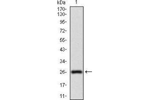 Western blot analysis using NT5E mAb against human NT5E (AA: 30-250) recombinant protein. (CD73 antibody  (AA 30-250))