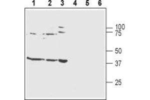 Western blot analysis of rat brain membranes (lanes 1 and 4), mouse brain membranes (lanes 2 and 5) and human SH-SY5Y neuroblastoma cell lysates (lanes 3 and 6): - 1-3. (KCNJ10 antibody  (C-Term, Intracellular))