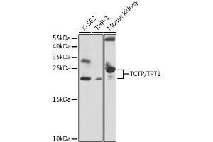 Western blot analysis of extracts of various cell lines, using TCTP/TCTP/TPT1 antibody  at 1:1000 dilution. (TPT1 antibody  (AA 1-172))