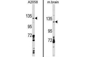 Image no. 1 for anti-C-Type Lectin Domain Family 16, Member A (CLEC16A) (C-Term) antibody (ABIN452846) (CLEC16A antibody  (C-Term))