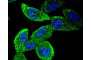 PC-3 cells were stained with STAT5b (12A1) Monoclonal Antibody  at [1:200] incubated overnight at 4C, followed by secondary antibody incubation, DAPI staining of the nuclei and detection. (STAT5B antibody)