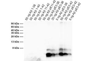 Detection of different synthetic Abeta species (dilution 1 : 1000).
