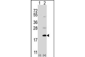 Western blot analysis of Ufc1 (arrow) using rabbit polyclonal Ufc1 Antibody (C-term) (ABIN650703 and ABIN2839221). (UFC1 antibody  (C-Term))