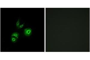 Immunofluorescence analysis of A549 cells, using MET Antibody. (c-MET antibody  (AA 276-325))