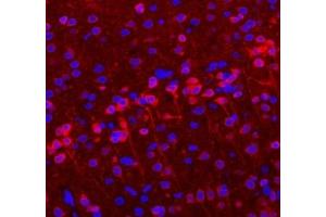 Immunofluorescent analysis of paraformaldehyde-fixed rat brain using VMAT2 (ABIN7075655) at dilution of 1: 1600 (SLC18A2 antibody)