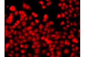 Immunofluorescence analysis of  cells using TH antibody (ABIN6128823, ABIN6149105, ABIN6149106 and ABIN6223361). (THAP1 antibody  (AA 1-213))