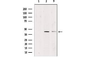 Western blot analysis of extracts from various samples, using CADM3 Antibody. (CADM3 antibody  (Internal Region))