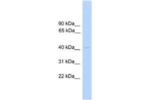 WB Suggested Anti-PRKAR1A Antibody Titration: 0. (PRKAR1A antibody  (C-Term))
