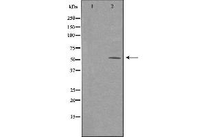Western blot analysis of extracts from HeLa cells using ARMC6 antibody.