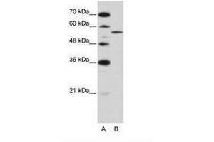 Image no. 2 for anti-Zinc Finger (CCCH Type), RNA-Binding Motif and serine/arginine Rich 2 (ZRSR2) (AA 369-418) antibody (ABIN202635) (ZRSR2 antibody  (AA 369-418))