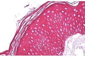 Anti-Cytokeratin 1 / Keratin 1 antibody IHC staining of human skin. (Cytokeratin 1 antibody  (Internal Region))