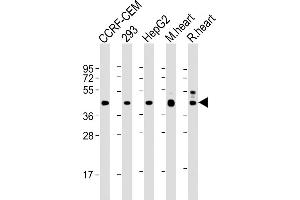 All lanes : Anti-VEGFC at 1:2000 dilution Lane 1: CCRF-CEM whole cell lysate Lane 2: 293 whole cell lysate Lane 3: HepG2 whole cell lysate Lane 4: mouse heart lysate Lane 5: rat heart lysate Lysates/proteins at 20 μg per lane. (VEGFC antibody)