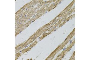 Immunohistochemistry of paraffin-embedded rat heart using REG3A antibody (ABIN6132545, ABIN6146855, ABIN6146856 and ABIN6216122) (40x lens). (REG3A antibody  (AA 27-175))