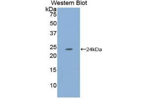 Western Blotting (WB) image for anti-Carbonic Anhydrase I (CA1) (AA 15-223) antibody (ABIN1173857) (CA1 antibody  (AA 15-223))