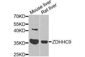 Western blot analysis of extracts of various cells, using ZDHHC9 antibody.