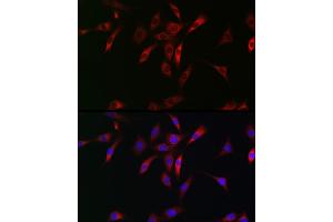 Immunofluorescence analysis of NIH/3T3 cells using NKIR Rabbit pAb (ABIN7268903) at dilution of 1:100 (40x lens).