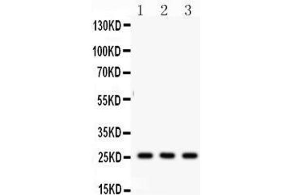 SFTPA2 antibody  (C-Term)