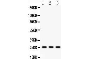 Anti- SFTP A1/2 Picoband antibody, Western blotting All lanes: Anti SFTP  at 0. (SFTPA1/ 2 (AA 206-237), (C-Term) antibody)