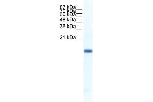 WB Suggested Anti-FERD3L Antibody   Titration: 1.