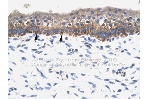 Immunohistochemistry (IHC) image for anti-SRY (Sex Determining Region Y)-Box 10 (SOX10) (Middle Region) antibody (ABIN2777864)