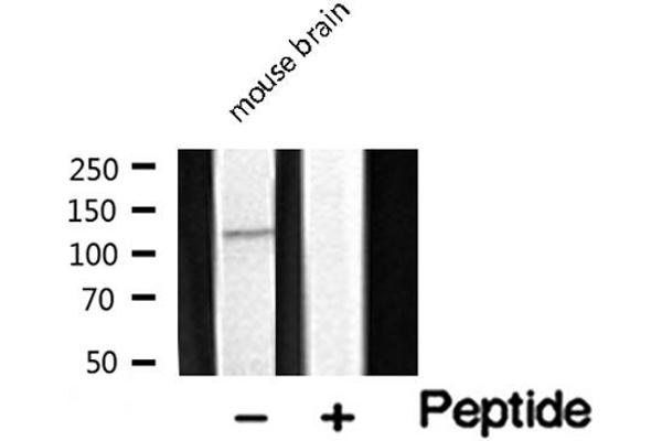 FARP2 antibody  (Internal Region)