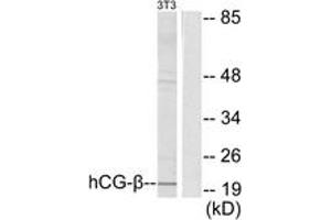 Western blot analysis of extracts from NIH-3T3 cells, using hCG beta Antibody. (HCG beta antibody  (AA 101-150))
