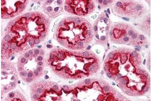 Human Kidney: Formalin-Fixed, Paraffin-Embedded (FFPE) (TAB3 antibody  (N-Term))