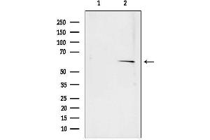 Western blot analysis of lysates from rat muscle, using SQLE antibody.
