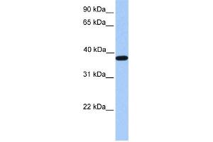 WB Suggested Anti-ACTRT2 Antibody Titration: 0. (ACTRT2 antibody  (C-Term))