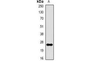 Western blot analysis of Rac 1 (pS71) expression in A431 EGF-treated (A) whole cell lysates.