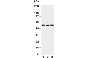 Western blot testing of XIAP antibody and Lane 1:  SMMC-7721;  2: HeLa;  3: A431 cell lysate (XIAP antibody  (N-Term))