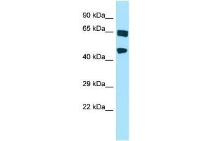 WB Suggested Anti-HABP4 Antibody Titration: 1.