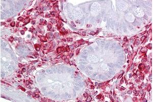 Immunohistochemistry (IHC) image for anti-Guanine Nucleotide Binding Protein (G Protein), beta Polypeptide 2-Like 1 (GNB2L1) (N-Term) antibody (ABIN2778965)