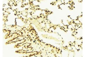 ABIN6273002 at 1/100 staining Mouse lung tissue by IHC-P. (ISCU antibody  (Internal Region))