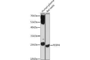 Western blot analysis of extracts of various cell lines, using PEBP4 Rabbit pAb (ABIN7269280) at 1:1000 dilution.
