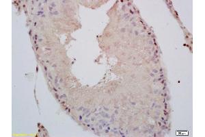 Formalin-fixed and paraffin embedded rat testis labeled with Rabbit Anti phospho-Androgen Receptor(Ser578) Polyclonal Antibody, Unconjugated (ABIN730123) at 1:200 followed by conjugation to the secondary antibody and DAB staining (Androgen Receptor antibody  (pSer578))