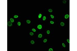 Immunofluorescence staining of A549 cells with ABIN7127548 at 1:43. (Recombinant HNRNPK antibody)