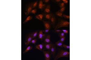 Immunofluorescence analysis of C6 cells using BCL3 Rabbit pAb (ABIN6134239, ABIN6137509, ABIN6137510 and ABIN7101379) at dilution of 1:100.