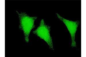 Immunofluorescence of monoclonal antibody to STAU1 on HeLa cell. (STAU1/Staufen antibody  (AA 401-496))