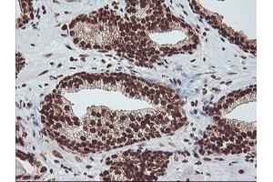 Image no. 1 for anti-Exosome Component 7 (EXOSC7) antibody (ABIN1498140) (EXOSC7 antibody)