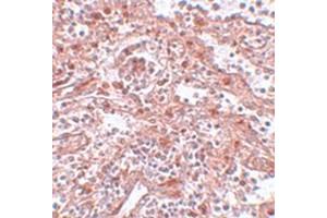 Immunohistochemical staining of human spleen tissue with LIN28 polyclonal antibody  at 5 ug/mL dilution. (LIN28A antibody  (C-Term))