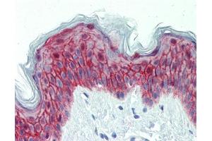 IHC-P Image Immunohistochemical analysis of paraffin-embedded human skin, using Galanin Receptor 2, antibody(10 μg/ml). (GALR2 antibody  (C-Term))