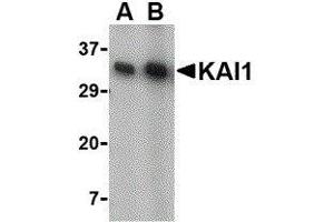 Western Blotting (WB) image for anti-CD82 (CD82) (C-Term) antibody (ABIN2472638) (CD82 antibody  (C-Term))