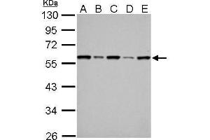 WB Image FKBP4 antibody detects FKBP4 protein by Western blot analysis. (FKBP4 antibody  (Center))