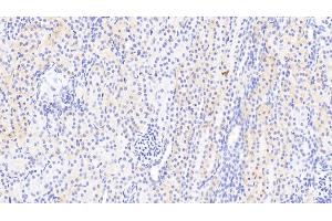 Immunohistochemistry (IHC) image for anti-Poly (ADP-Ribose) Polymerase Family, Member 4 (PARP4) (AA 338-609) antibody (ABIN7435292)