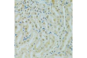 Immunohistochemistry of paraffin-embedded mouse kidney using RCC1 antibody. (RCC1 antibody  (AA 1-240))