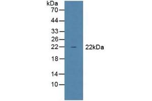 Detection of GPX1 in Mouse Liver Tissue using Polyclonal Antibody to Glutathione Peroxidase 1 (GPX1) (Glutathione Peroxidase 1 antibody  (AA 50-203))