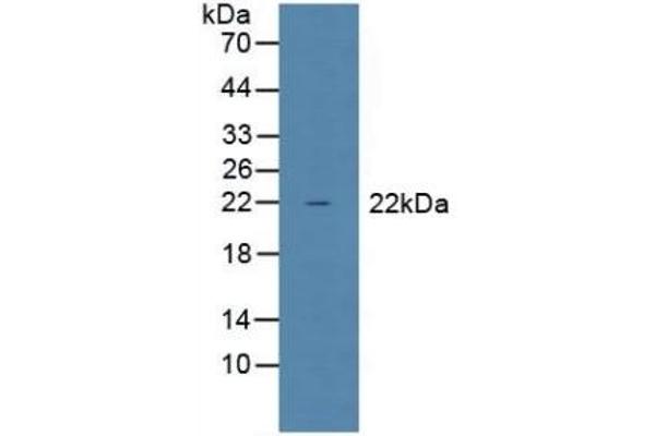 Glutathione Peroxidase 1 antibody  (AA 50-203)